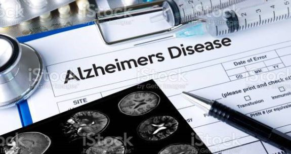 Awareness for Alzheimer’s Disease